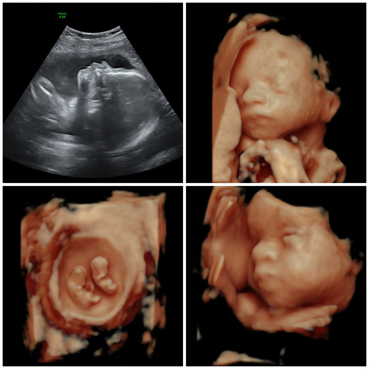 Ultrasound Packages